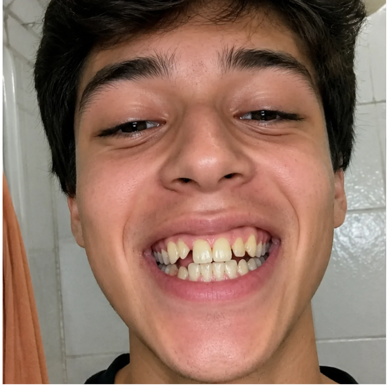 Antes del tratamiento — caso 1
